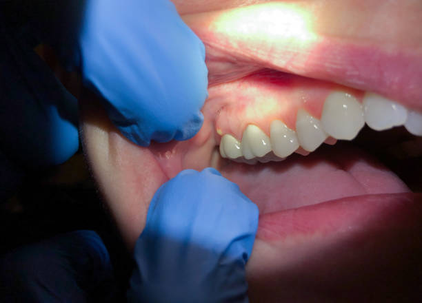 Best Emergency Dental Surgery in Okemos, MI