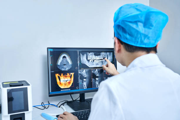 Best Emergency Root Canal Treatment in Okemos, MI