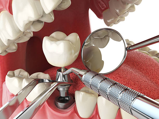 Best Walk-In Emergency Dentist in Okemos, MI