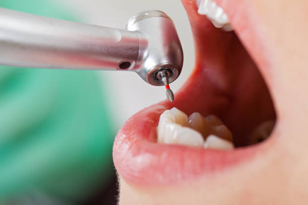 Best Emergency Treatment for Toothache in Okemos, MI